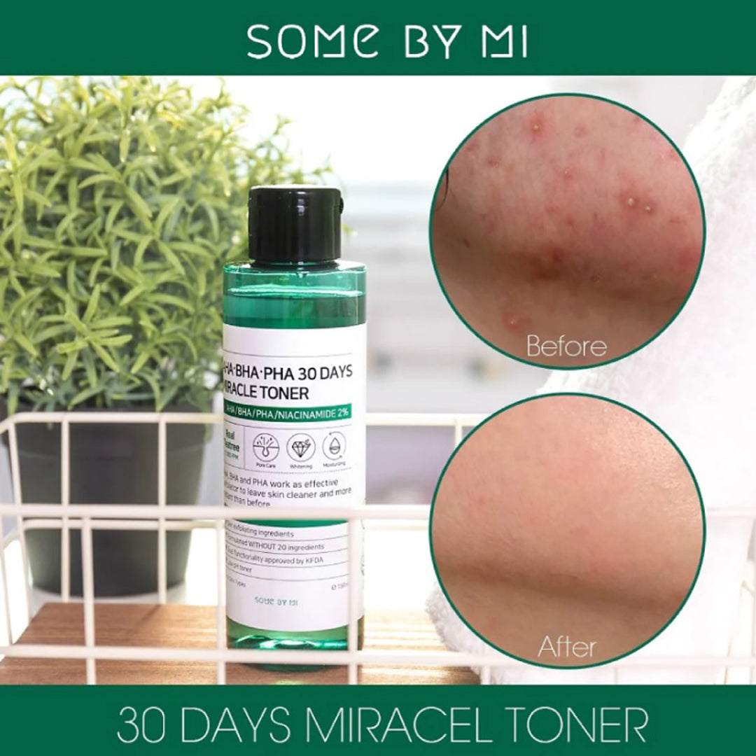Some by mi™ - Aha-Bha-Pha 30 Days Miracle Toner