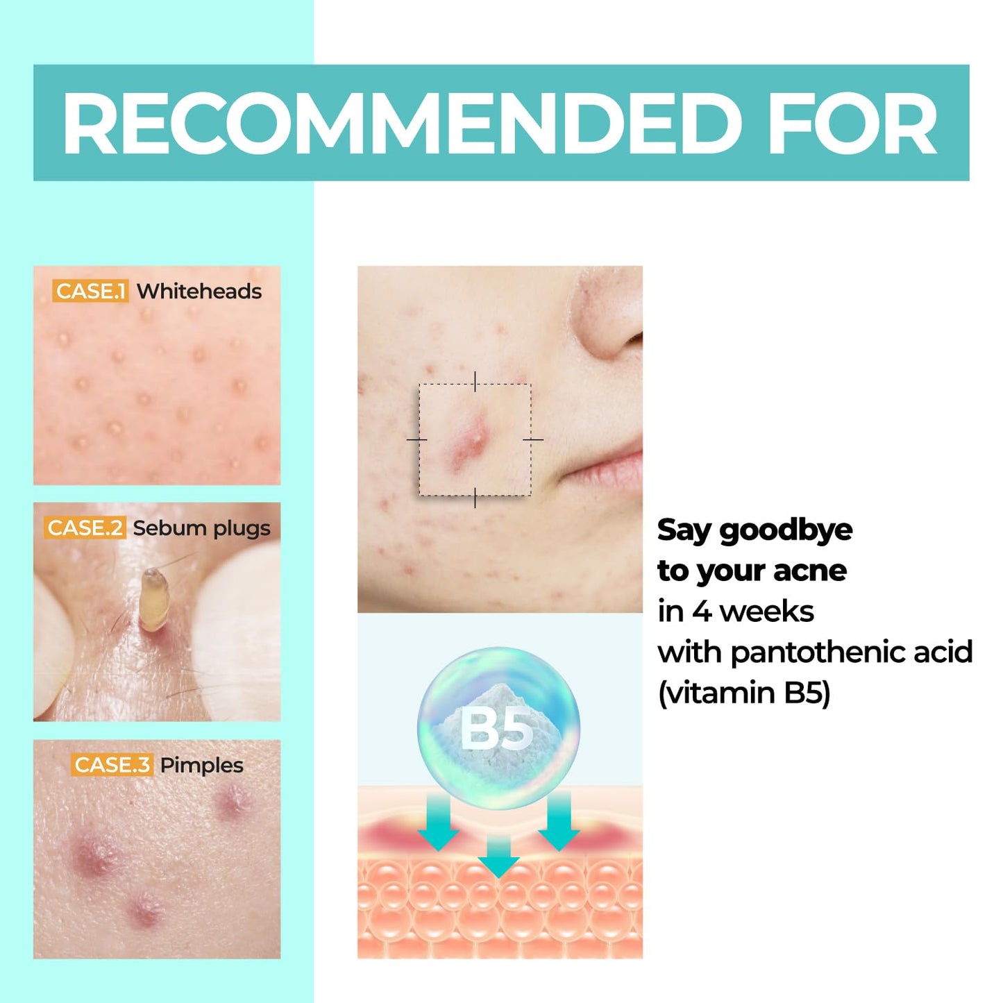 Numbuzin - No. 1 Pantothenic B5 Active Soothing Cream