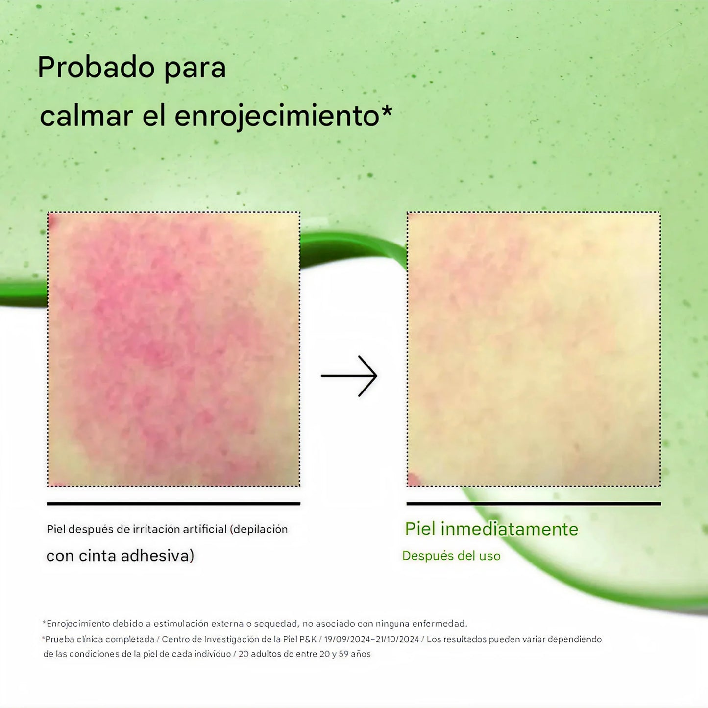 Anua -  Azelaic Acid 10% Serum