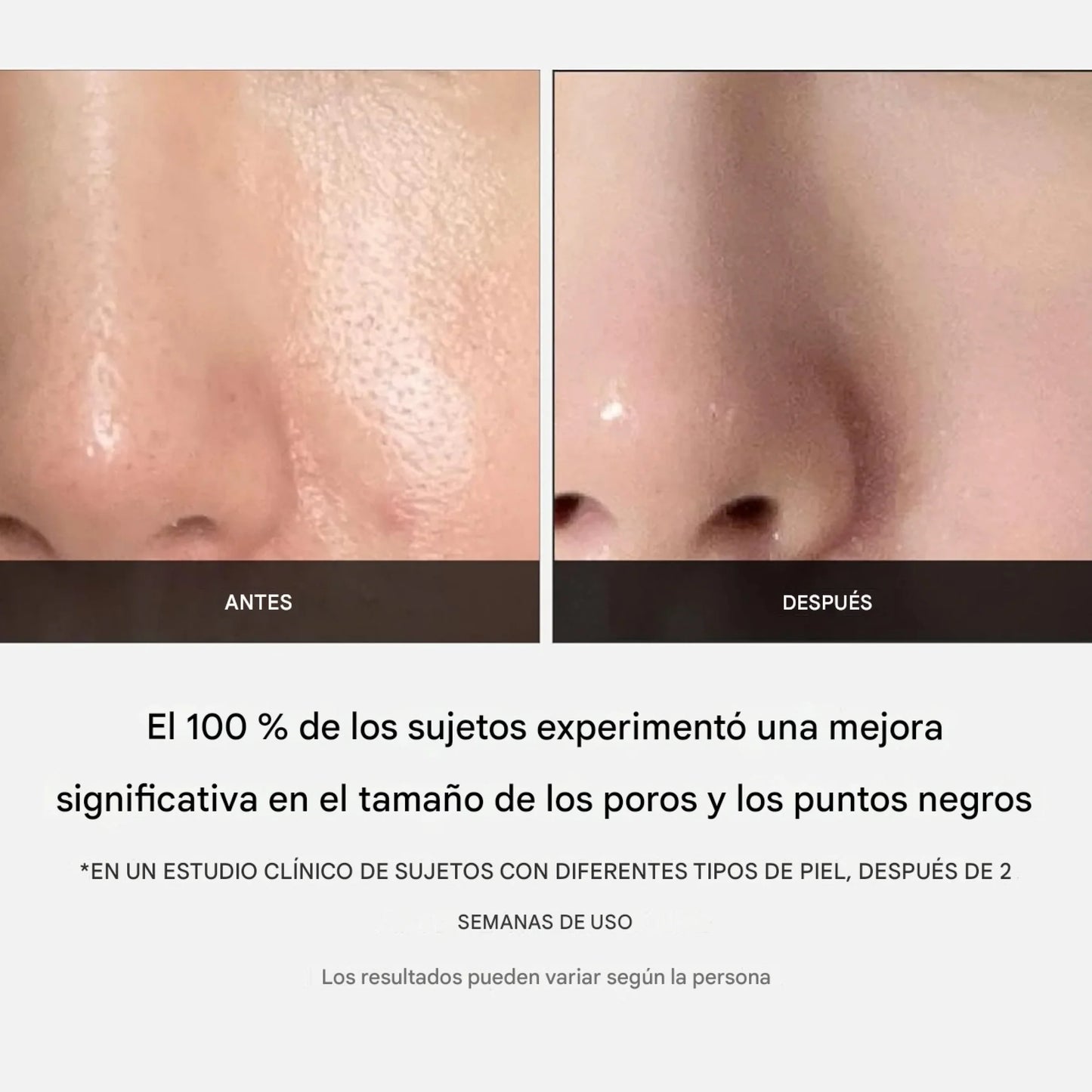 Medicube - Zero Pore Pad 2.0