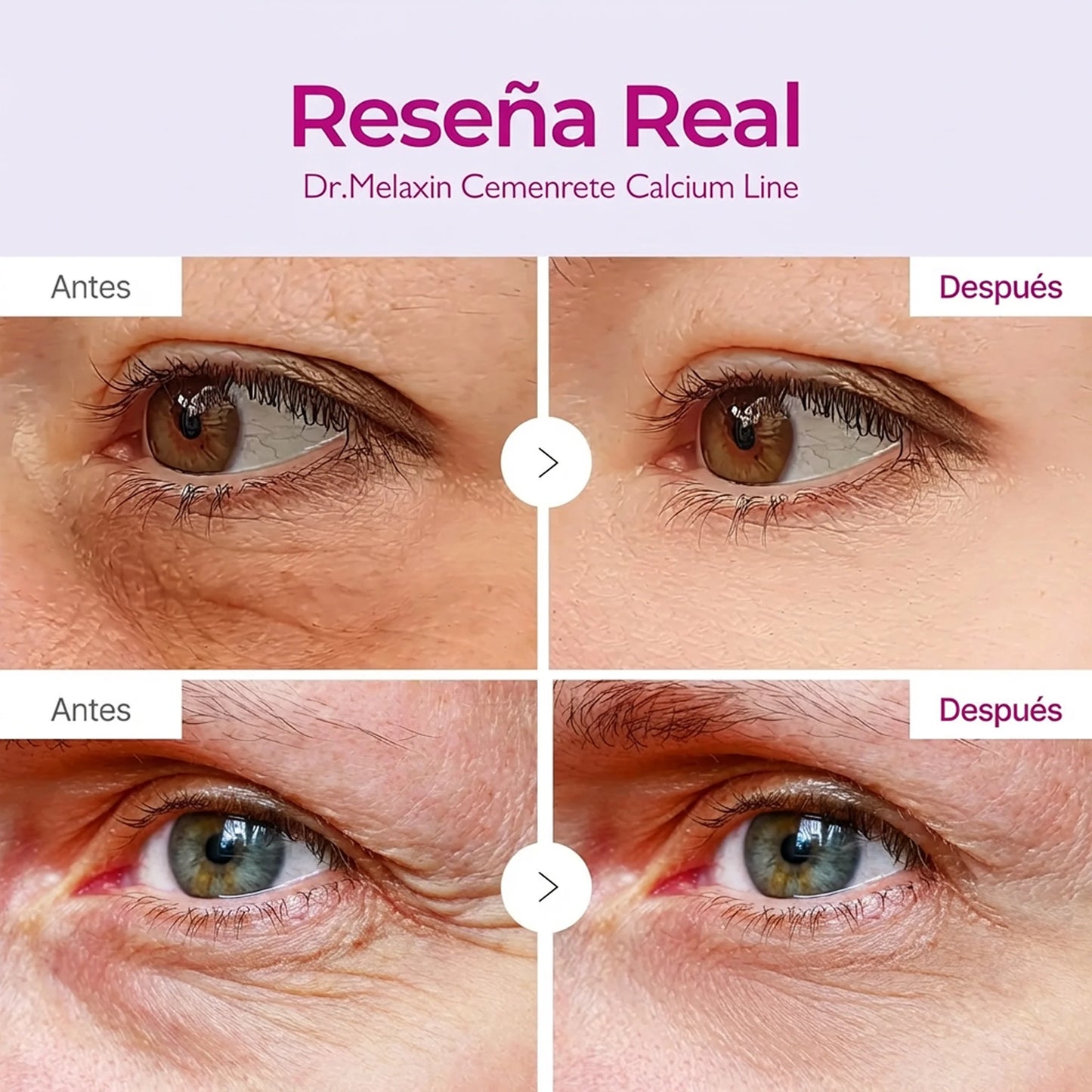 Dr. Melaxin - Cemenrete Calcium Volume Eye Patch (60 parches)