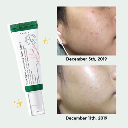 Axis-Y™  - Dark Spot Correcting Glow Serum